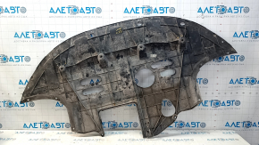 Защита двигателя Hyundai Elantra AD 17-20 2.0 примятости, трещины