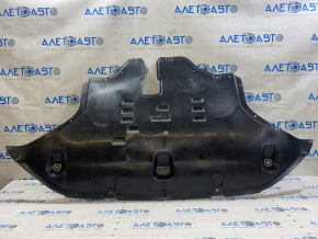 Защита двигателя Hyundai Santa Fe 19-20 2.0, 2.4