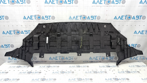Защита переднего бампера Volvo XC60 18-26