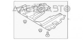 Защита двигателя Ford Fusion mk5 17-20 надрывы, потерта