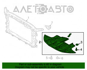 Защита двигателя Hyundai Elantra AD 17-20 2.0